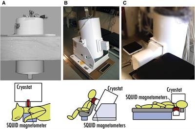 SQUID magnetoneurography: an old-fashioned yet new tool for noninvasive functional imaging of spinal cords and peripheral nerves